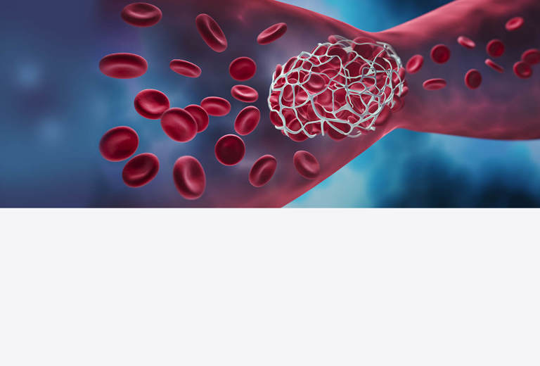 Heparin-induzierte Thrombozytopenie (HIT)