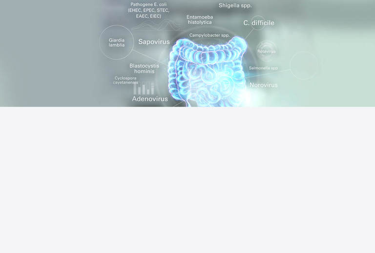 Gastroenteritiserreger mit Multiplex-PCR